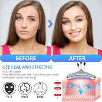 Massage Intense Pulsed Light Wrinkles Reducing Instrument - ESX - Anti Ageing & Reduces Puffiness | Face Massage For Fine Line & Wrinkle