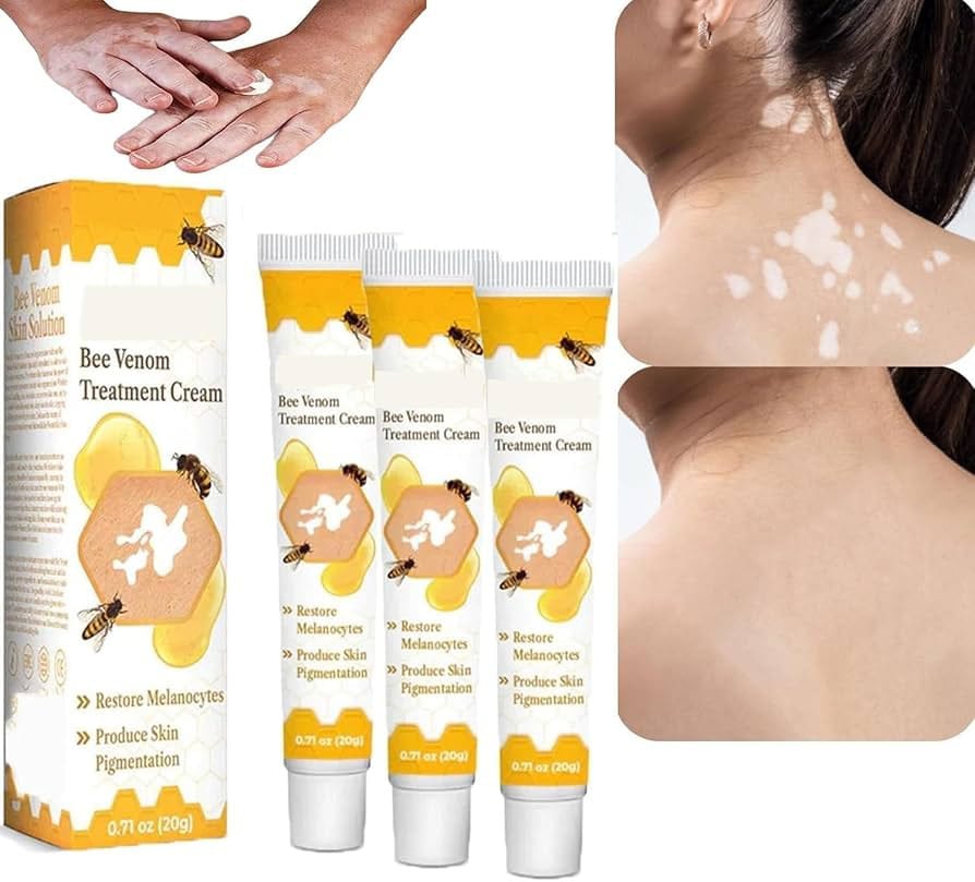 Fivfivgo™ VitiGO Bee Venom Correcting Cream (20g) – Advanced Melanocyte Support for Skin Pigmentation Recovery and Even Skin Tone