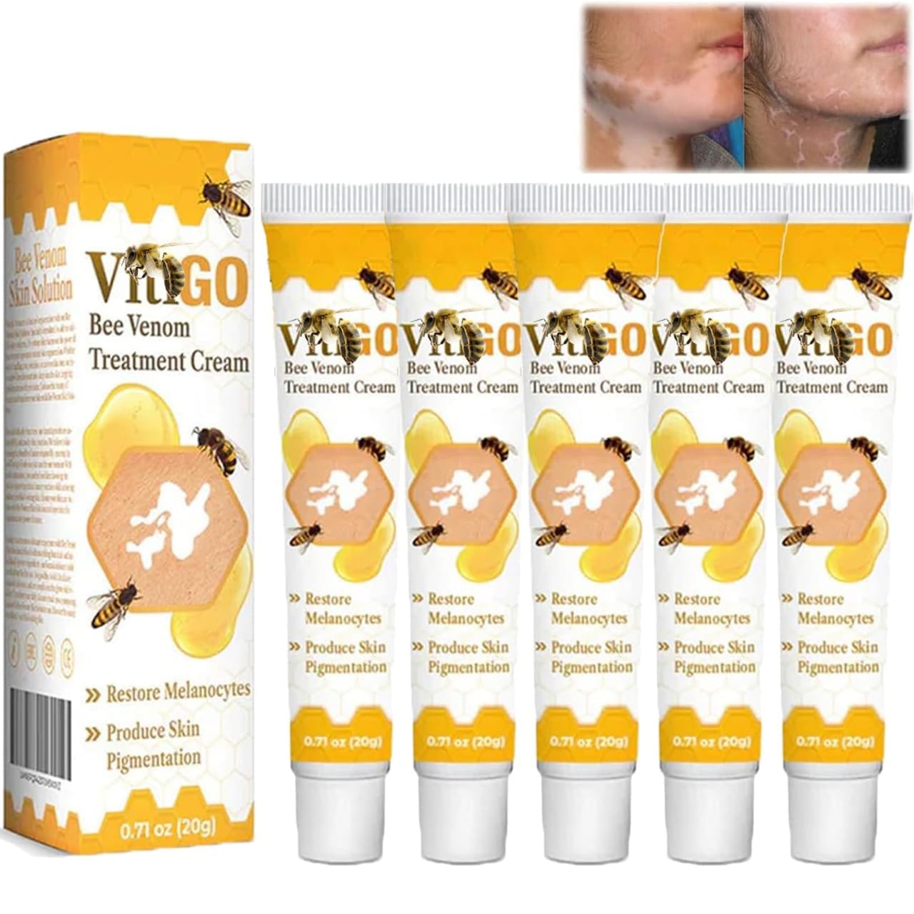 Fivfivgo™ VitiGO Bee Venom Correcting Cream (20g) – Advanced Melanocyte Support for Skin Pigmentation Recovery and Even Skin Tone