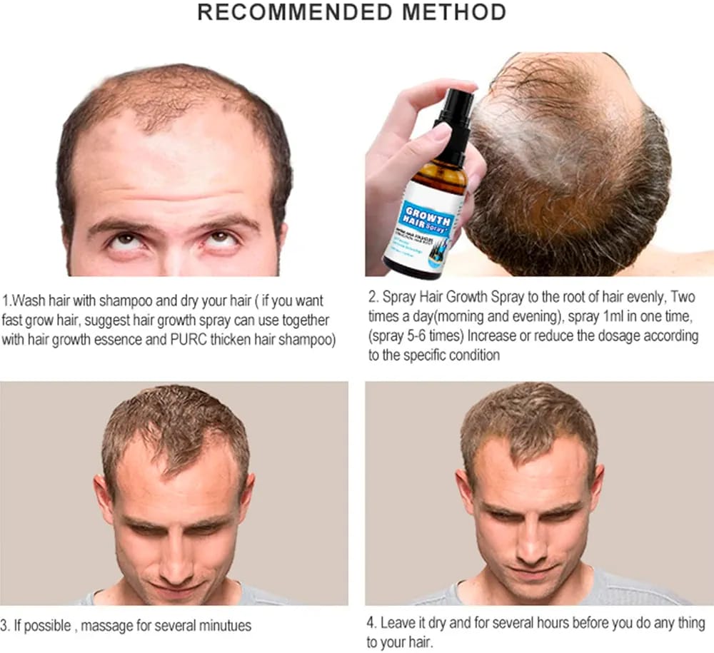 Disaar Vegan Ginseng Root Hair Growth Spray 30ml (DS4002) | Natural Hair Strengthener & Anti-Hair Loss Treatment